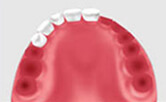 北京维尔口腔医院价格,前牙反颌形成的因素