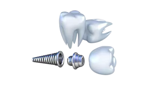 蛀牙智齿引起的大囊肿 下頜骨都被侵蚀