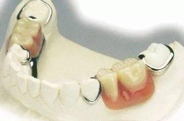 换牙期需要补钙吗？