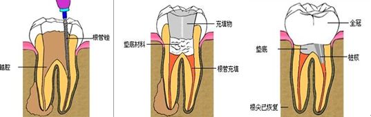 前另“兜齿儿”是怎么回事，有什么危害