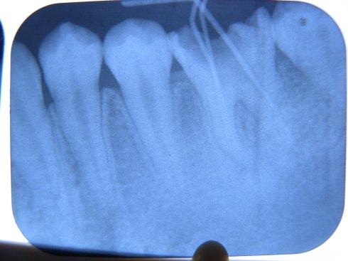 如何保护乳牙不生弱齿、健康坚固呢？