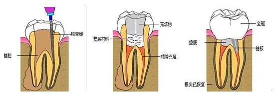 什么叫牙颌畸形？