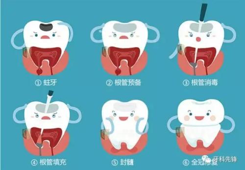 G用氟预防能使牙齿都不晶坏吗？