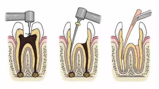 乳牙脱落后久久不长恒牙需要去医踪检查吗？