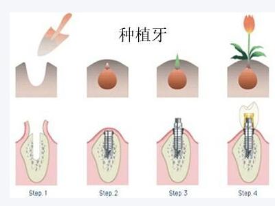 儿童从几岁开始刷牙好？