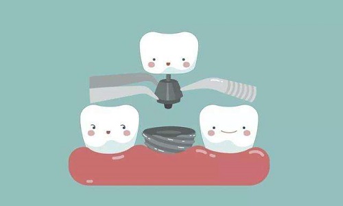 全口义齿修复的最佳时期是什么？