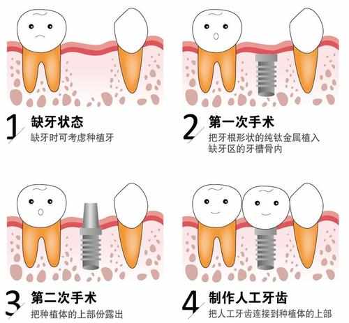 保持口气清新的方法