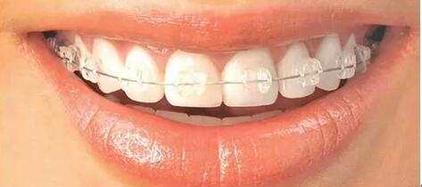种植牙的缺点有哪些？