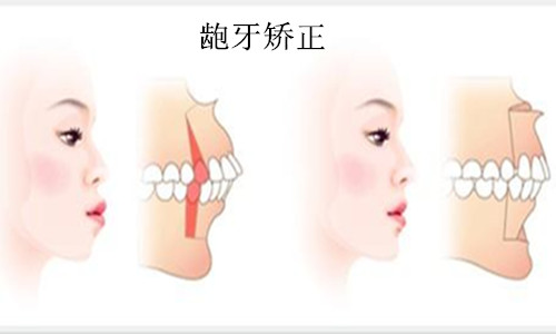 64第一章 牙根反复肿胀化脓是怎么回事