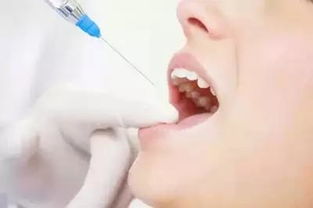 牙床手术什么时候开始做？
