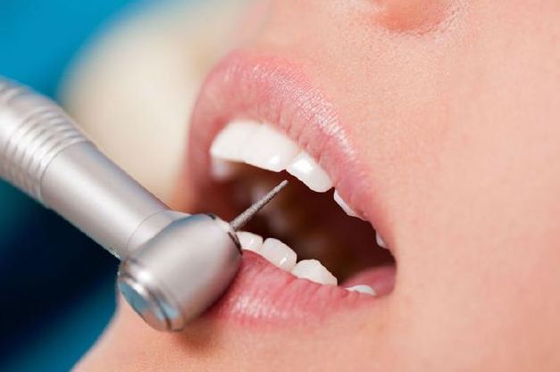 哪些因素会导致补牙材料脱落？