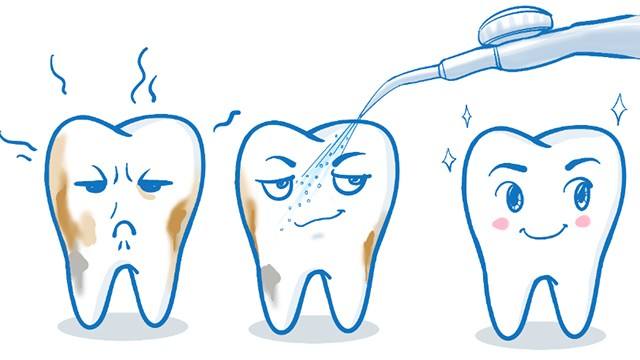 拔牙后多长时间能镶牙？