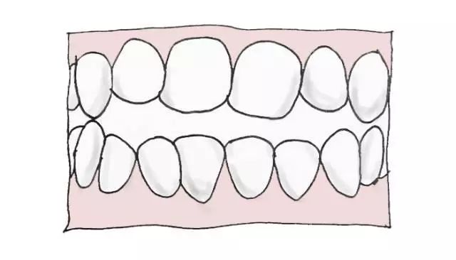 对图自测你的牙齿需要矫正么？