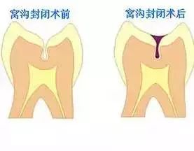 牙齿这件事“少小不矫正老大徒伤悲”！