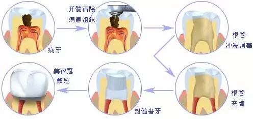 一般人我不告诉他如何看牙最省钱！