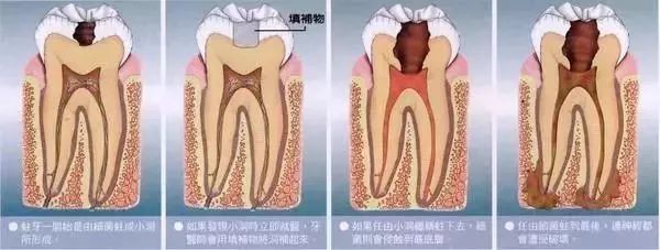 牙痛就忘了全世界；牙一好就忘了牙医。