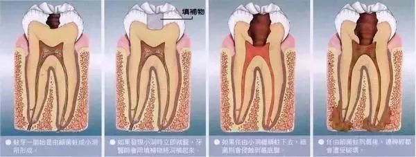 牙痛就忘了全世界；牙一好就忘了牙医。