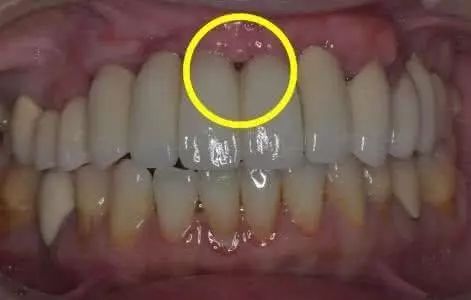 医生我的牙齿为什么越来越长了？