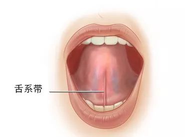 我家孩子发音不清怎麼办？是舌繫带的问题吗？