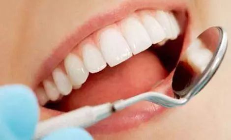 洗牙 — 世界上最省钱的治疗方式