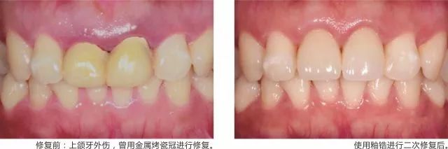 正畸诊疗过程详解，你不来看看吗？