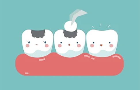 filling-tooth-teeth-concept-dental-260nw-663748447