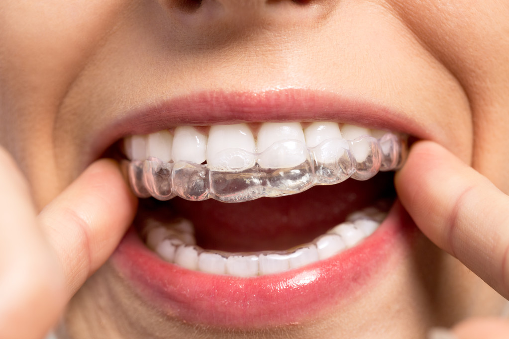 牙齿矫正，按时复诊的重要性你了解吗？