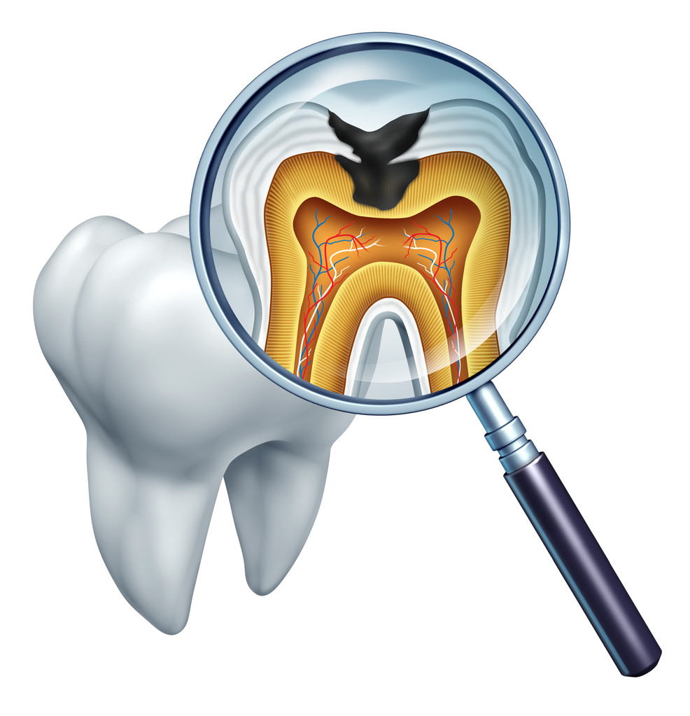 牙疼未必是“上火”，不同的牙病有不同的特征！