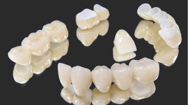 深圳全瓷牙收费