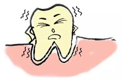 牙齿松动需要拔牙吗