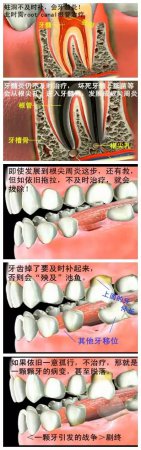 一颗蛀牙引发的战争